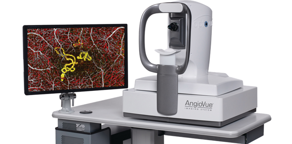 Lensed Fiber in Optical Coherence Tomography Lensed Fiber in Optical Coherence Tomography